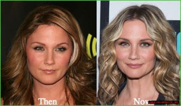 Jennifer Nettles' Plastic Surgery Transformation Exposed