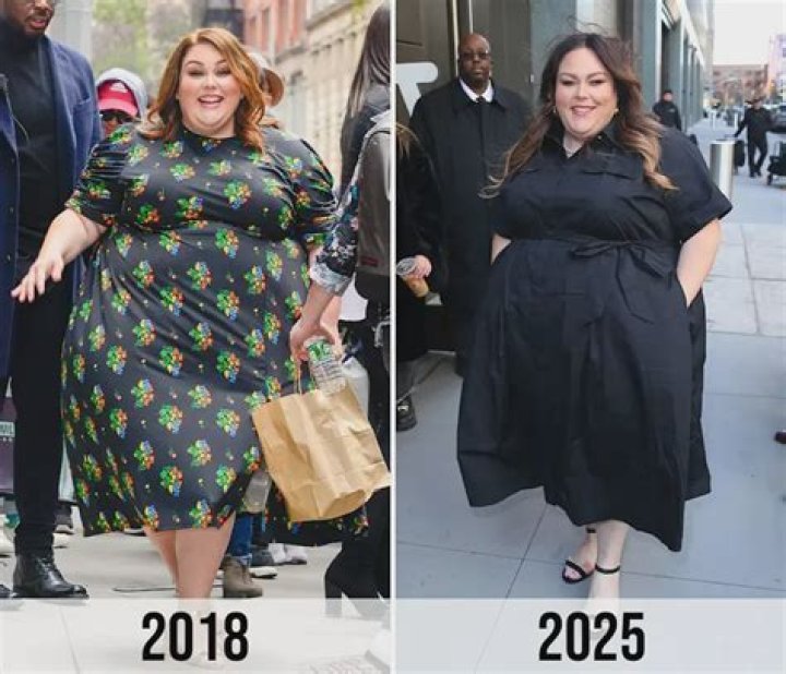 Unveiling Rikkie's Remarkable Pre-Surgery Transformation Journey