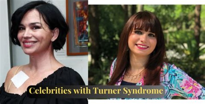 Unveiling The Stories Of 10 Inspiring Celebrities With Turner Syndrome