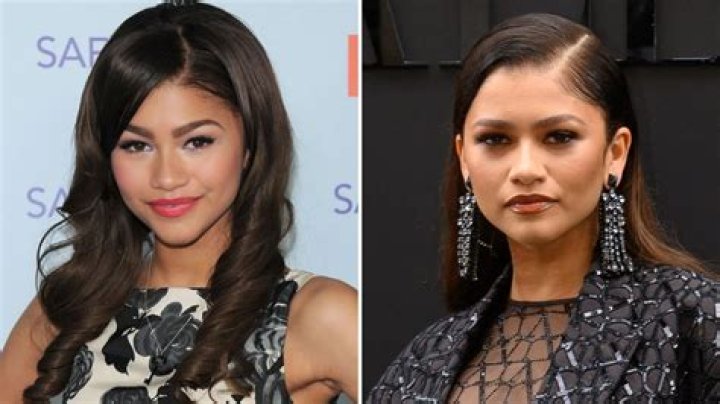 Zendaya's Plastic Surgery Enigma Revealed
